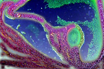 Pathogénie de la ménopause.